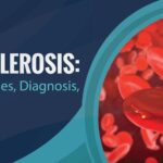 Atherosclerosis and heart problems: Prevention and management
