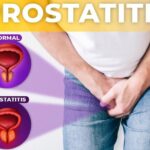 Prostatitis should not be confused with prostate cancer