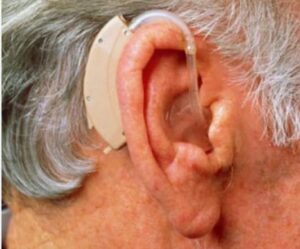 Hearing impairment in Elderly couples : Impact on marital adjustments 