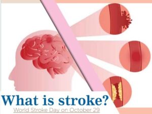 Stroke is a state of Medical Emergency