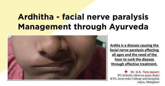 Ardhita-facial-nerve-paralysis