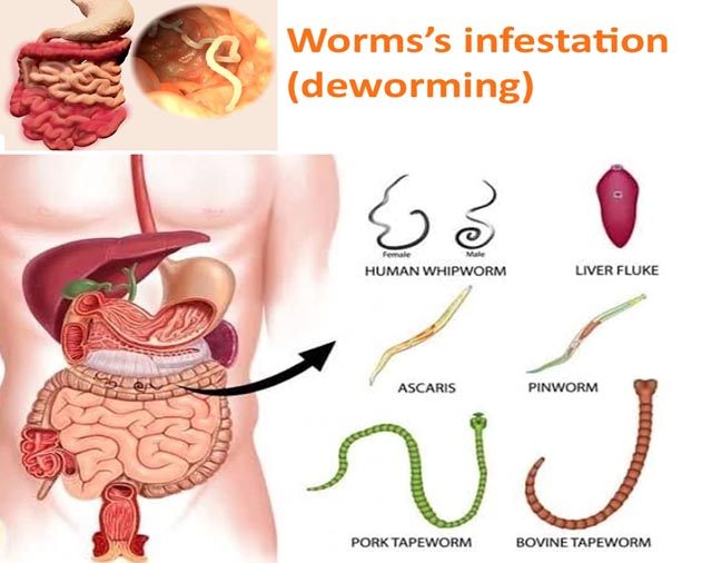 ATTACHMENT DETAILS Worms-infestation