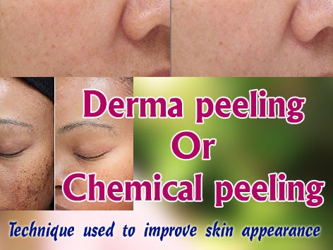 derma-peeling-or-chemical-peeling