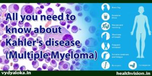 Kahler’s Disease or Multiple myeloma- blood cancer where plasma cells in the blood grow uncontrolled