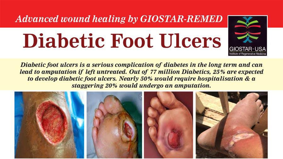 Diabetic-foot-ulcers