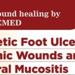Advanced wound healing for Diabetic Foot Ulcers & Chronic Wounds