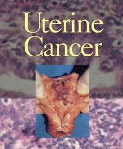 Uterine-cancer