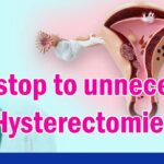 Hysterectomy should be the last resort for a woman