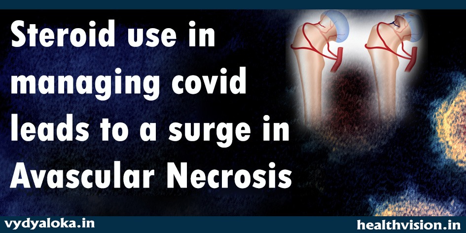 Steroid use in managing COVID leads to a surge in Avascular Necrosis
