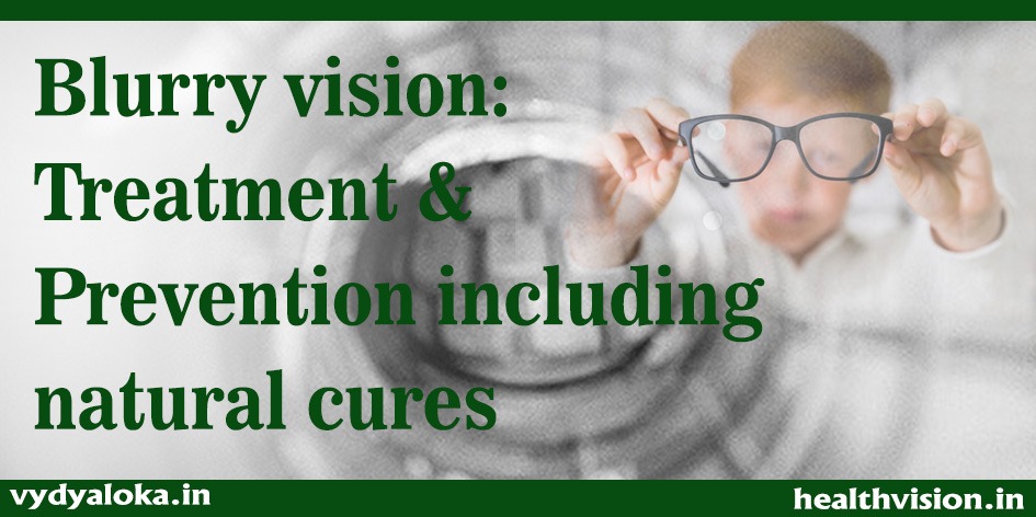 Blurry Vision: Treatment & Prevention Including Natural Cures