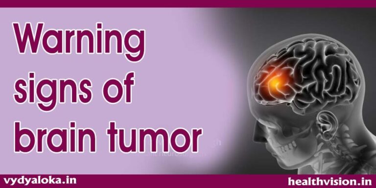 Brain Tumor : Warning Signs One Must Not Ignore - Health Vision