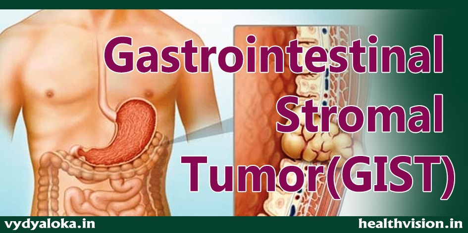 Abdominal pain and loss of appetite can be a sign of Gastrointestinal Stromal Tumour (GIST)