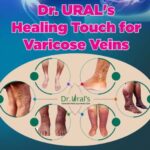 Dr. URAL's Healing Touch for Varicose Veins