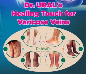 Dr. URAL's Healing Touch for Varicose Veins