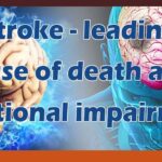 Stroke is the leading cause of death and functional impairment