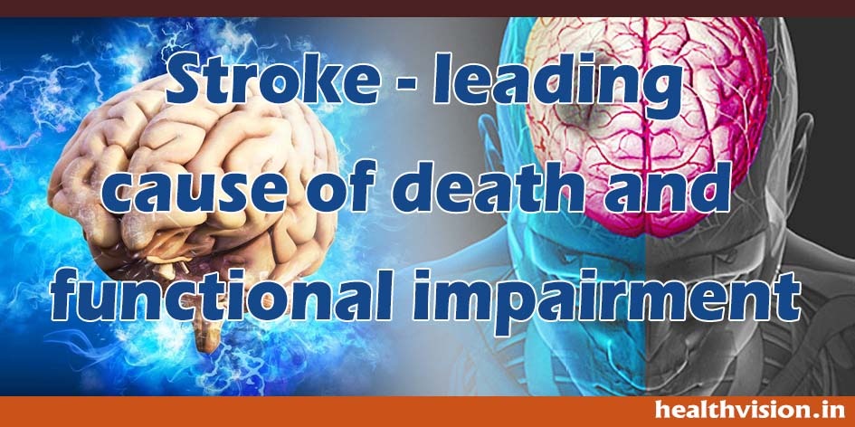 Stroke-is-the-leading-cause-of-death.jpeg October 28, 2022
