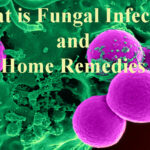 What is Fungal Infection and home remedies