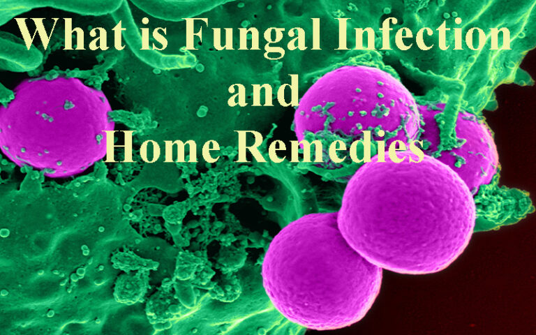 what-is-fungal-infection-and-home-remedies