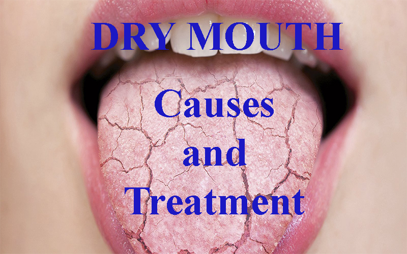 Dry mouth – Causes and Treatment - Health Vision