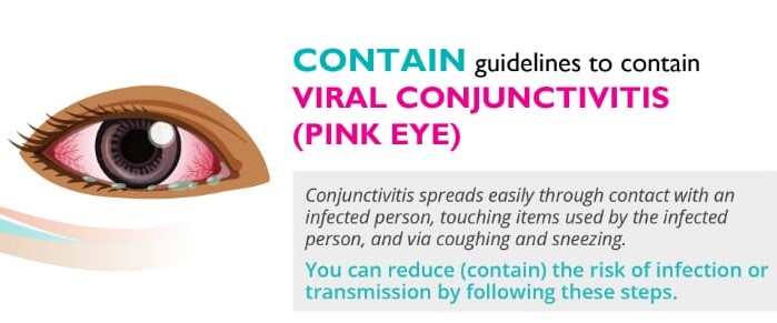 CONTAIN-Viral-Conjunctivitis