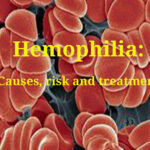 Understanding Hemophilia - Causes and treatment