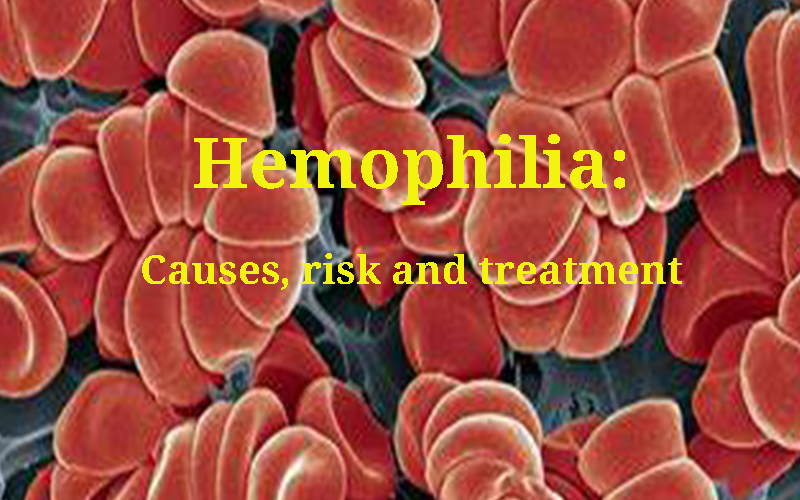 Hemophilia - Causes, risk and treatment