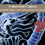 Colorectal Cancer: Spotting Signs and Embracing Prevention