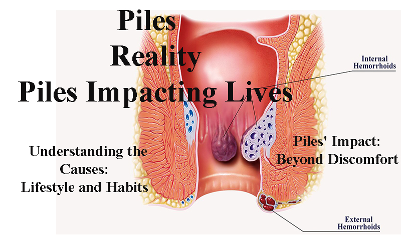 Piles Impacting Lives