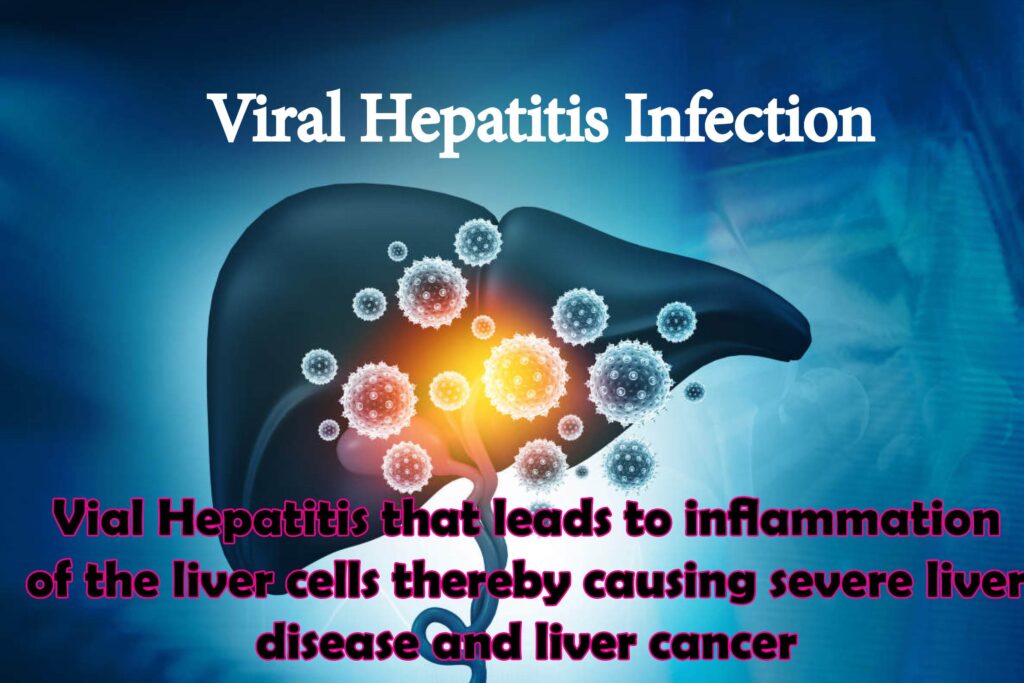 Viral hepatitis infection