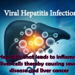 Viral hepatitis infection - A cause of serious concern
