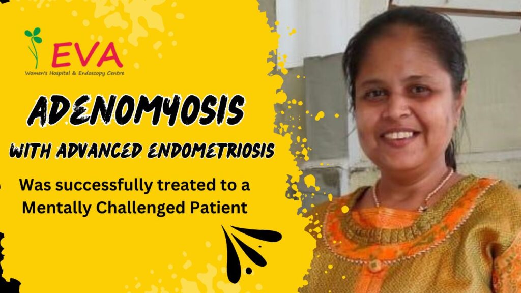 Adenomyosis was successfully treated at Eva Womens Hospital