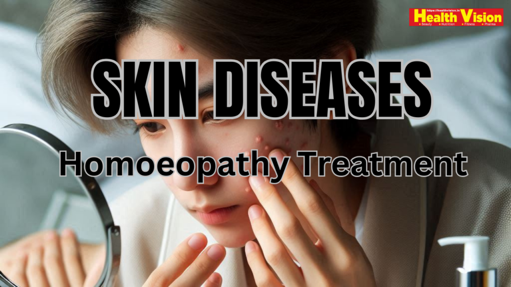 Skin Diseases and Homoeopathy #vydyaloka #healthvision