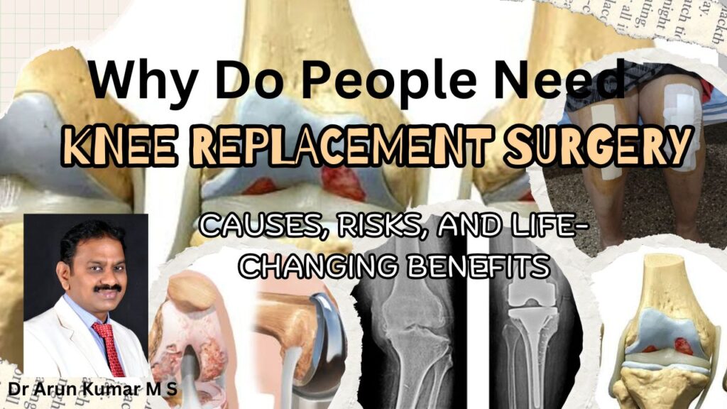 Why Do People Need Knee Replacement - Causes, Risks, and Life-Changing Benefits #vydyaloka #healthvision