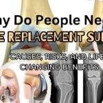 Why Do People Need Knee Replacement surgery?