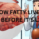 KNOW FATTY LIVER: ACT BEFORE IT’S LATE