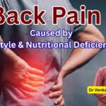 #backpain - Caused by Lifestyle & Nutritional Deficiencies #drvenkataramanahegde #vydyaloka #healthvision