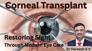 Corneal Transplant #abhisheknethradhama #drhareeshkv #eyehospital #yelahanka #vydyaloka #healthvision
