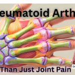 #rheumatoidarthritis arthritis #drvenkataramanahegde #nisargamanesirsi #vedawellness #vydyaloka #healthvision