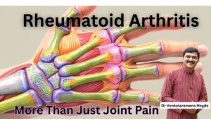#rheumatoidarthritis arthritis #drvenkataramanahegde #nisargamanesirsi #vedawellness #vydyaloka #healthvision