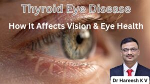 Thyroid Eye Disease #abhisheknethradhama #drhareeshkv #eyehospital #yelahanka #vydyaloka #healthvision #childeyecare #thyroideyedisease