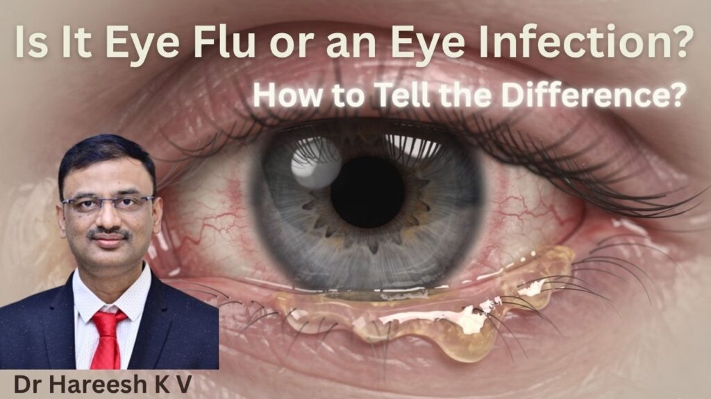 #eyeflu #eyeinfection #abhisheknethradhama #drhareeshkv #eyehospital #yelahanka #vydyaloka #healthvision