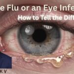 #eyeflu #eyeinfection #abhisheknethradhama #drhareeshkv #eyehospital #yelahanka #vydyaloka #healthvision