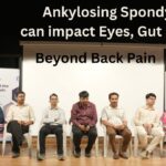 Ankylosing Spondylitis can impact Eyes, Gut and Skin #vydyaloka #healthvision