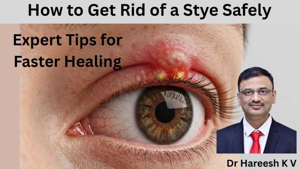 Stye Safely - Tips for Faster Healing #abhisheknethradhama #drhareeshkv #eyehospital #yelahanka #vydyaloka #healthvision