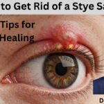 Stye Safely - Tips for Faster Healing #abhisheknethradhama #drhareeshkv #eyehospital #yelahanka #vydyaloka #healthvision
