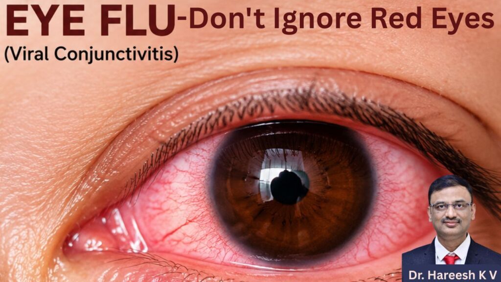 #eyeflu #redeyes #abhisheknethradhama #drhareeshkv #eyehospital #yelahanka #vydyaloka #healthvision