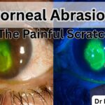 Corneal Abrasion #abhisheknethradhama #drhareeshkv #eyehospital #yelahanka #vydyaloka #healthvision